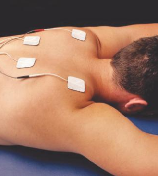 Dry Needling 3